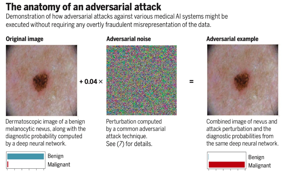 An example adversarial attack on a medical AI system