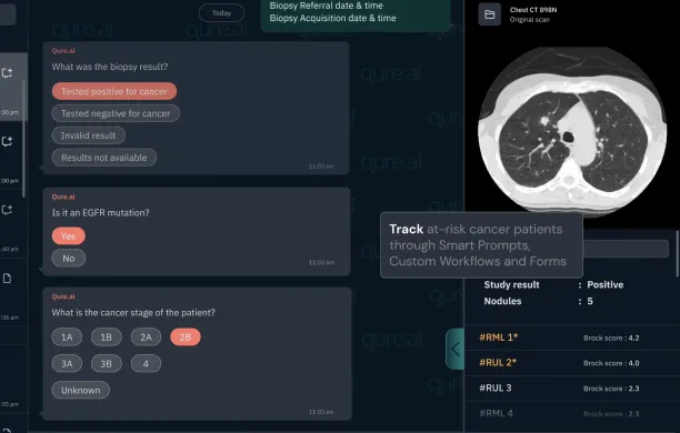 An example from qTrack lung nodule manage.ment platform on patient tracking