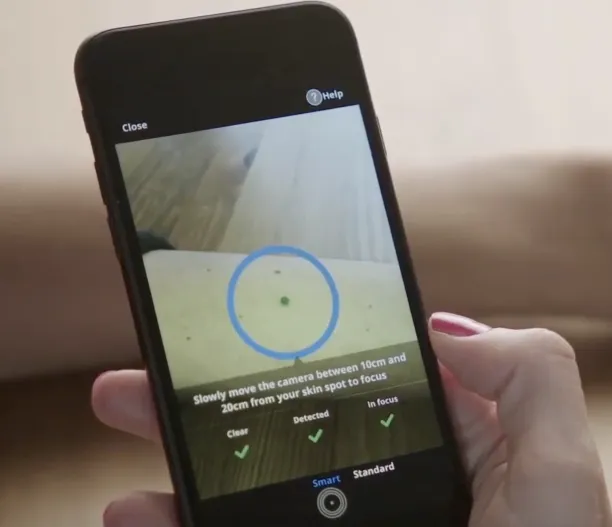 An example usage of AI in dermatology: SkinVision's skin cancer detection interface.