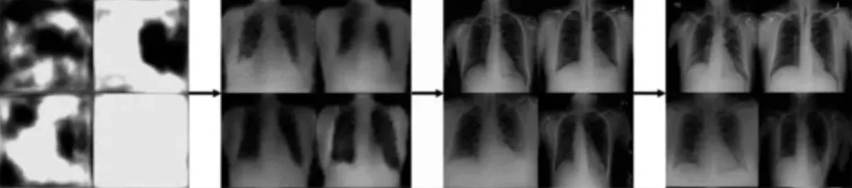 Image showing 14-hour-long progressive outputs of a generative AI healthcare model to produce fake chest X-rays.