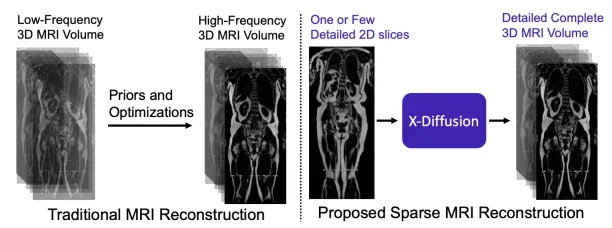 An example for generative AI healthcare applications: A comparison between traditional MRI reconstruction vs X-Diffusion.