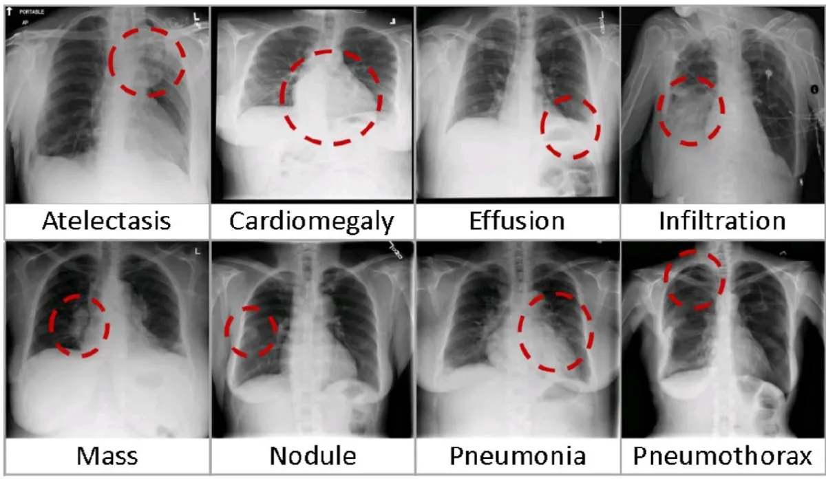 Sample of x-ray image classifications by a deep learning image classification model
