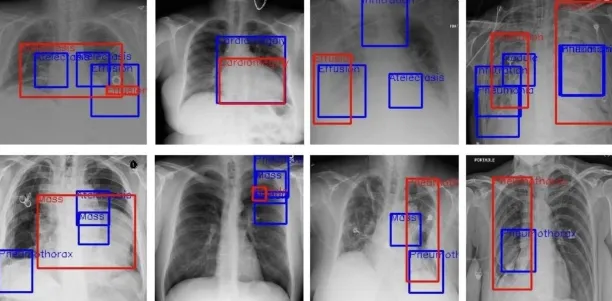 Different images of chest x-rays with box labels.