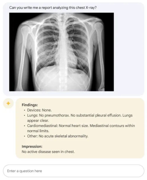 Med-PaLM M example on describing a chest X-Ray.