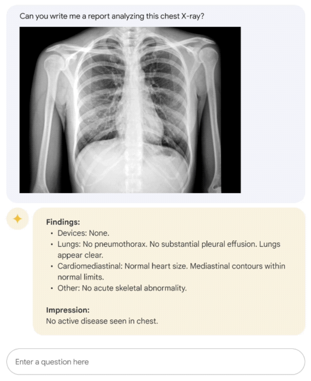 Med-PaLM M example on describing a chest X-Ray.